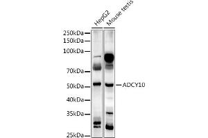 Western blot analysis of extracts of various cell lines, using  antibody (ABIN7265465) at 1:1000 dilution. (ADCY10 Antikörper)