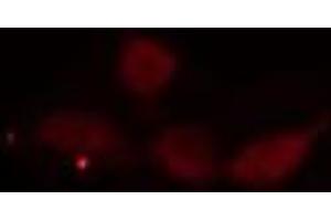 ABIN6275552 staining  Hela cells by IF/ICC. (PPP4R2 Antikörper  (Internal Region))