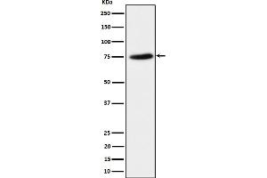 Western blot analysis of PPM1G expression in HeLa cell lysate. (Rekombinanter PPM1G Antikörper)