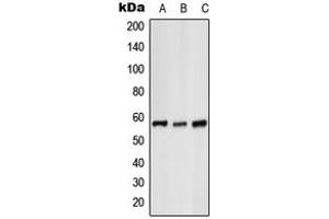 Western blot analysis of Glycerol Kinase 1 expression in HeLa (A), mouse liver (B), H9C2 (C) whole cell lysates. (Glycerol Kinase 1 Antikörper  (C-Term))