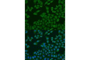 Immunofluorescence analysis of U2OS cells using PLA2G4C antibody (ABIN2737385) at dilution of 1:100. (PLA2G4C Antikörper)