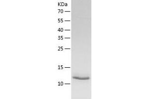 Western Blotting (WB) image for Melanoma Antigen Family A, 5 (MAGEA5) (AA 1-124) protein (His tag) (ABIN7123890) (MAGEA5 Protein (AA 1-124) (His tag))