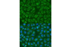 Immunofluorescence analysis of U2OS cells using PIP5K1B antibody (ABIN6130645, ABIN6145684, ABIN6145686 and ABIN6223693) at dilution of 1:100. (PIP5K1B Antikörper  (AA 190-470))