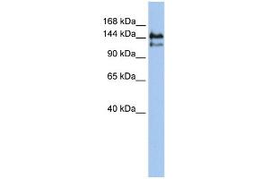 WB Suggested Anti-SUPT5H Antibody Titration:  0. (SUPT5H Antikörper  (Middle Region))