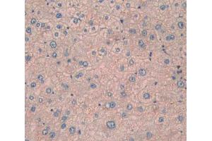 IHC-P analysis of liver tissue, with DAB staining. (CPN1 Antikörper  (AA 159-325))