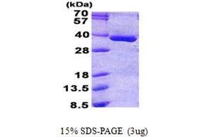 Phosphoglycolate Phosphatase (PGP) protein (His tag)