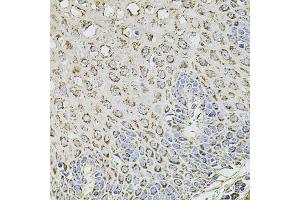 Immunohistochemistry of paraffin-embedded human esophagus using TMC1 antibody. (TMC1 Antikörper)