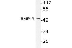 Western blot analysis of BMP-5 Antibody in extracts from HUVEC cells. (BMP5 Antikörper)