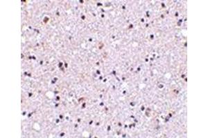 Immunohistochemistry of TMP21 in human brain tissue with this product at 5 μg/ml. (TMED10 Antikörper  (Center))