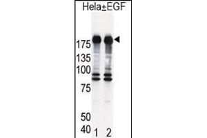 Western blot analysis of EGFR (arrow) in Hela cell lysates, either induced (Lane 1) or noninduced with EGF (Lane 2). (EGFR Antikörper  (AA 1048-1077))