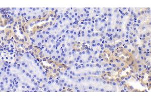 Detection of FN in Mouse Kidney Tissue using Polyclonal Antibody to Fibronectin (FN)