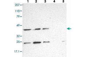 Western blot analysis of Lane 1: RT-4, Lane 2: EFO-21, Lane 3: A-431, Lane 4: Liver, Lane 5: Tonsil with DRG1 polyclonal antibody . (DRG1 Antikörper)