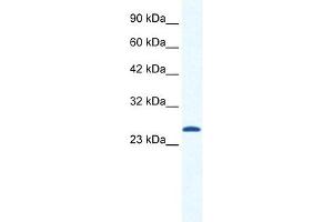 Western Blotting (WB) image for anti-Calcium Channel, Voltage-Dependent, gamma Subunit 6 (CACNG6) (N-Term) antibody (ABIN630072)