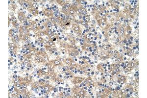 Tetraspanin 32 antibody was used for immunohistochemistry at a concentration of 4-8 ug/ml to stain Hepatocytes (arrows) in Human Liver.