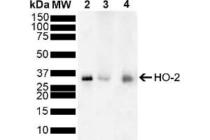 Western blot analysis of Mouse, Rat Brain showing detection of ~36 kDa HO-2 protein using Rabbit Anti-HO-2 Polyclonal Antibody (ABIN5696131). (HMOX2 Antikörper  (FITC))