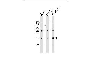 All lanes : Anti-SRP14 Antibody (Center) at 1:2000 dilution Lane 1:  whole cell lysate Lane 2: HepG2 whole cell lysate Lane 3: SH-SY5Y whole cell lysate Lysates/proteins at 20 μg per lane. (SRP14 Antikörper  (AA 28-55))