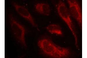 Immunofluorescence (IF) image for anti-Heat Shock Factor Protein 1 (HSF1) (pSer307) antibody (ABIN7138540)