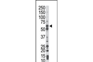 Antibody is used in Western blot to detect PCK1 in mouse liver tissue lysate. (PCK1 Antikörper  (N-Term))