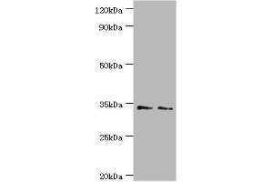 Western blot All lanes: Killer cell immunoglobulin-like receptor 2DS4 antibody at 4 μg/mL Lane 1: K562 whole cell lysate Lane 2: Jurkat whole cell lysate Secondary Goat polyclonal to rabbit IgG at 1/10000 dilution Predicted band size: 34 kDa Observed band size: 34 kDa (KIR2DS4 Antikörper  (AA 22-245))