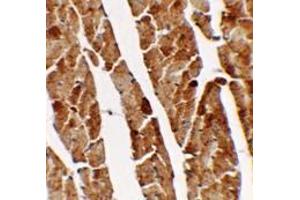 Immunohistochemistry of TGM5 in mouse heart tissue with TGM5 antibody at 2.
