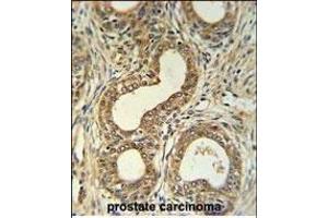 Immunohistochemistry (Paraffin-embedded Sections) (IHC (p)) image for anti-Roundabout, Axon Guidance Receptor, Homolog 4 (ROBO4) (AA 236-264), (N-Term) antibody (ABIN651292)