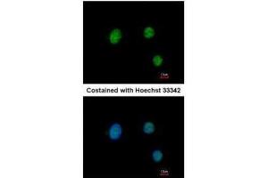ICC/IF Image Immunofluorescence analysis of paraformaldehyde-fixed HeLa, using PAX9, antibody at 1:200 dilution.