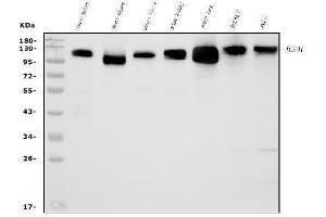 Western blot analysis of Icam1 using anti-Icam1 antibody (ABIN7601978).