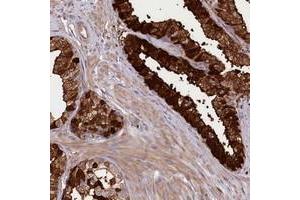 Immunohistochemical staining of human prostate with KIAA1731 polyclonal antibody  shows strong cytoplasmic and membranous positivity in glandular cells at 1:200-1:500 dilution.