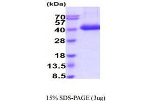 SDS-PAGE (SDS) image for Tissue Factor Pathway Inhibitor (Lipoprotein-Associated Coagulation Inhibitor) (TFPI) (AA 29-304) protein (His tag) (ABIN7529364)