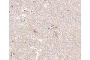Immunohistochemistry (IHC) image for anti-Potassium Voltage-Gated Channel, Shaw-Related Subfamily, Member 2 (KCNC2) (C-Term) antibody (ABIN6262739)