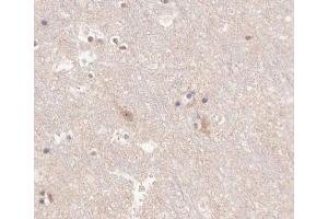 ABIN6266625 at 1/100 staining human brain tissue sections by IHC-P.