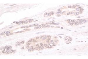 Immunohistochemistry (IHC) image for anti-ATR Interacting Protein (ATRIP) (AA 100-150) antibody (ABIN7453575) (ATRIP Antikörper  (AA 100-150))