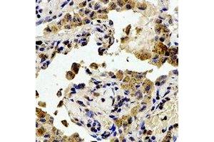Immunohistochemistry (IHC) image for anti-PTK2 Protein tyrosine Kinase 2 (PTK2) (pTyr407) antibody (ABIN7303906)