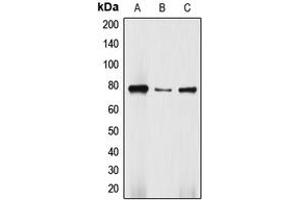 Western blot analysis of DBF4 expression in Jurkat (A), HepG2 (B), SW480 (C) whole cell lysates. (DBF4 Antikörper  (N-Term))