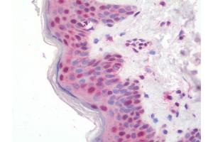 Immunohistochemistry (IHC) image for anti-Zinc Finger, Matrin Type 2 (ZMAT2) antibody (FITC) (ABIN1957202)
