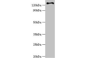 Western blot All lanes: RET antibody at 6 μg/mL + Hela whole cell lysate Secondary Goat polyclonal to rabbit IgG at 1/10000 dilution Predicted band size: 125, 120 kDa Observed band size: 125 kDa (Ret Proto-Oncogene Antikörper  (AA 29-300))