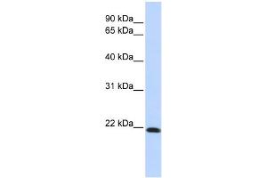 WB Suggested Anti-CLDN7 Antibody Titration:  0. (Claudin 7 Antikörper  (Middle Region))