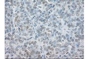 Immunohistochemical staining of paraffin-embedded Ovary tissue using anti-SORDmouse monoclonal antibody.