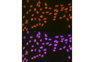 Immunofluorescence analysis of C6 cells using EWSR1 Rabbit mAb (ABIN7267053) at dilution of 1:100 (40x lens). (EWSR1 Antikörper)