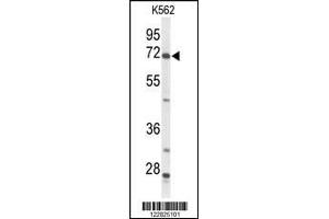 Western blot analysis of ACSS2 Antibody in K562 cell line lysates (35ug/lane) (ACSS2 Antikörper  (N-Term))