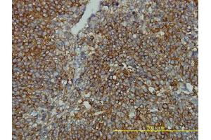 Image no. 1 for anti-Clathrin, Light Chain B (CLTB) (AA 1-212) antibody (ABIN598618) (CLTB Antikörper  (AA 1-212))