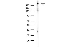 anti-Microtubule-Associated Protein 1B (MAP1B) (Internal Region) antibody