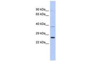 Image no. 1 for anti-SAR1 Homolog B (SAR1B) (AA 107-156) antibody (ABIN6744023) (SAR1B Antikörper  (AA 107-156))