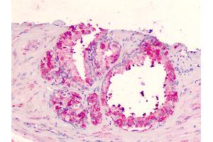 Human Prostate: Formalin-Fixed, Paraffin-Embedded (FFPE) (GPR183 Antikörper  (Extracellular Domain))