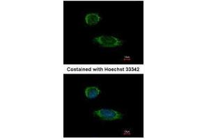 ICC/IF Image Immunofluorescence analysis of methanol-fixed HeLa, using Caspase 1 alpha, antibody at 1:500 dilution. (Caspase 1 Antikörper)