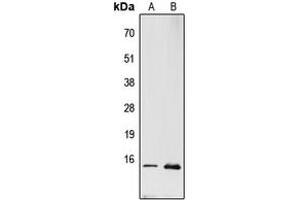 Western blot analysis of RPL22 expression in PC12 (A), MCF7 (B) whole cell lysates. (RPL22 Antikörper  (Center))