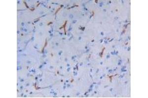 IHC-P analysis of Mouse Brain Tissue, with DAB staining. (Albumin Antikörper)
