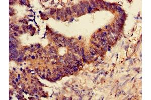 Immunohistochemistry (IHC) image for anti-Proteasome (Prosome, Macropain) Subunit, beta Type, 4 (PSMB4) (AA 46-264) antibody (ABIN7164978)