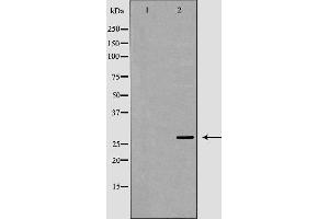 Western blot analysis of extracts of mouse brain, using MOG antibody.