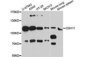 Western blot analysis of extracts of various cell lines, using CDH11 antibody. (OB Cadherin Antikörper)